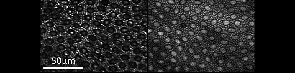 Reflectance (left) and two-photon excited fluorescence (right) image of the photoreceptor mosaic in the living macaque eye.