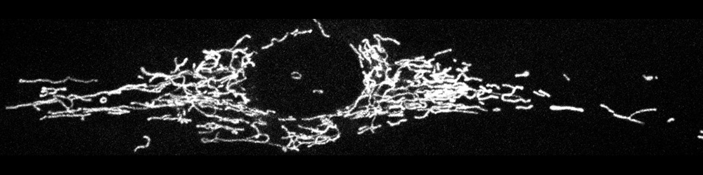 Confocal image of the labeled mitochondrial network inside a corneal fibrobast in culture
