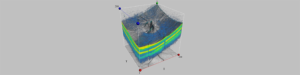 3D visualization: Optic disk cube