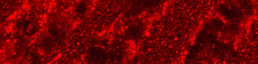 Ex vivo two-photon microscopy image of ganglion cells